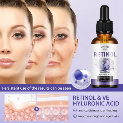 Retinol Serum, Serum for face, Anti aging serum, Professional Facial Serum, Retinol serum with HA & Vitamin E, serum for open pores, serum for oily skin, hydrating and moisturizing serum
