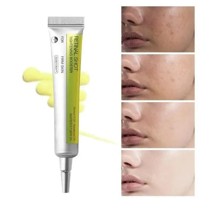 Retinal Shot Tightening Booster, Retinol Shot Tightening Serums, Retinal Mild Face Moisturising Cream for All Skin Types, Repairs and Enhances Skin Elasticity,15g