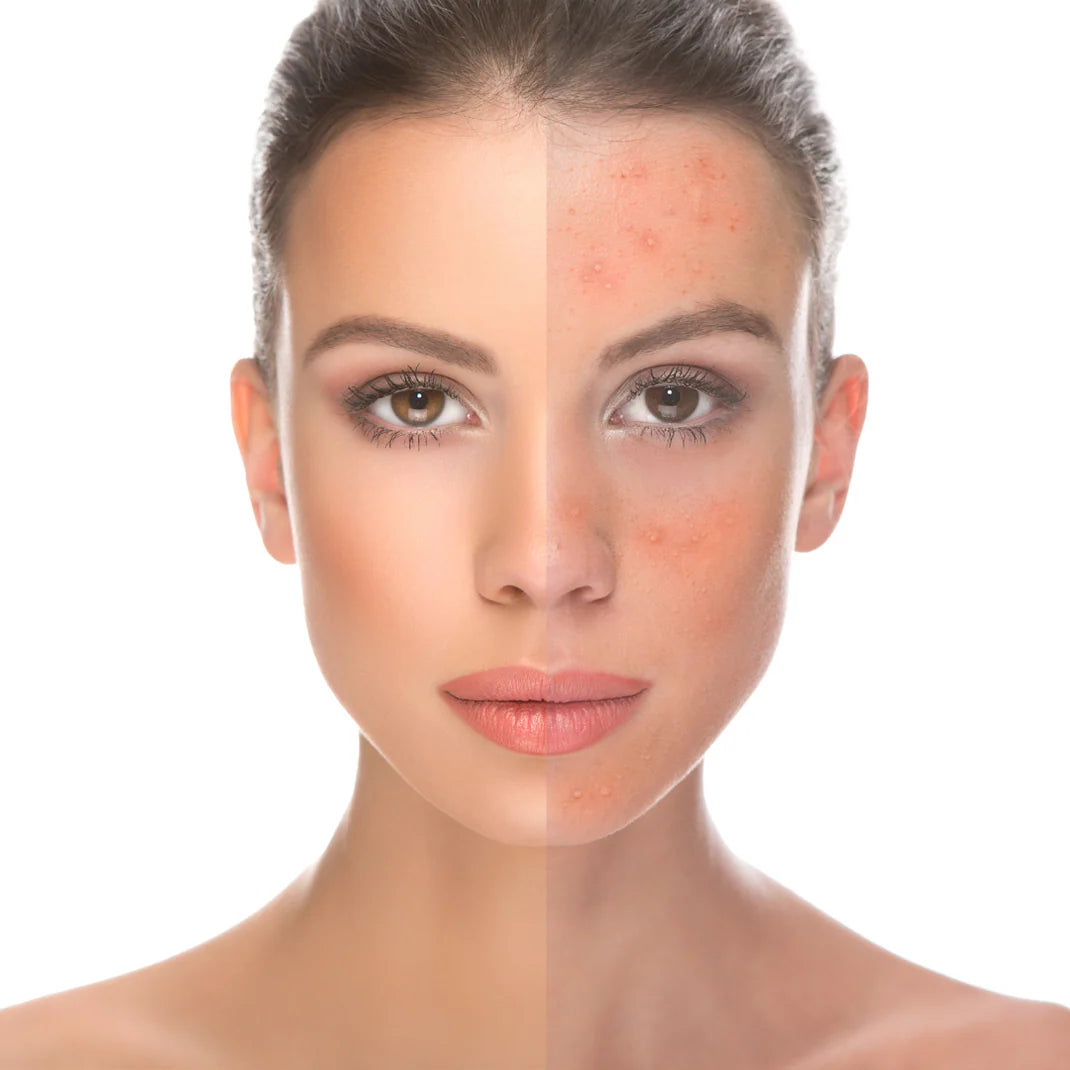 FV Liquid Foundation, Oil Absorb Ivory Liquid Foundation Matte Oil Free Medium Coverage & Light weight | Best Tube 30g